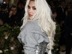 Kim Kardashian Curhat Putranya Idap Penyakit Vitiligo, Kondisi Apa Itu?