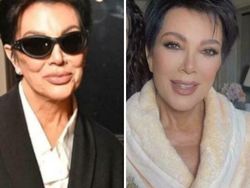 Mencengangkan! Perbandingan Foto di Medsos Vs Kenyataan