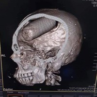 Foto Sebelum Tragedi Terjadi