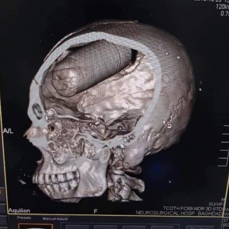 Foto Sebelum Tragedi Terjadi