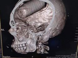 Foto Sebelum Tragedi Terjadi, Ceritanya Mengerikan Bikin Merinding