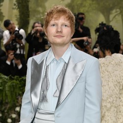 Ed Sheeran Kasih Kabar Baru, Kini Botak Hingga Akui Sakit Herpes