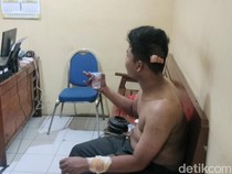 Pemuda Dibacok Emak-emak Usai Cekcok di Kamar Hotel Ternyata Sopir Rental