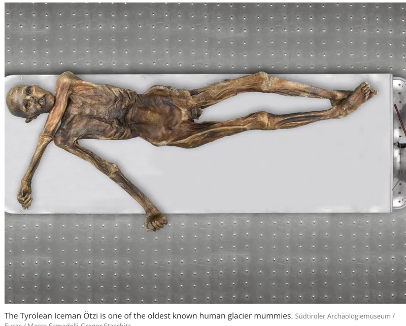 Mumi Otzi