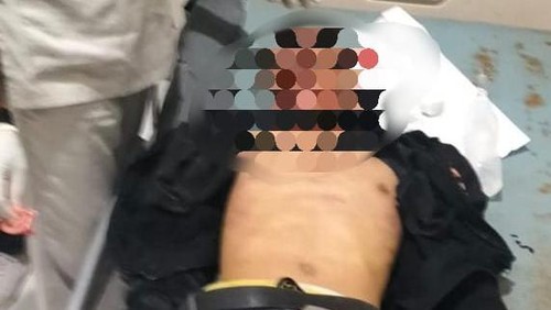 Korban tabrakan motor dengan pikap di Flores Timur, Jumat (10/5/2024) malam.