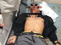 Kecelakaan Maut Motor Vs Pikap di Flores Timur, 1 Orang Tewas