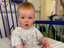 Terlahir Tuli, Bayi Ini Bisa Mendengar Usai Jalani Uji Coba Terapi Genetik