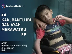 Cerita Anak Juru Parkir Penderita Cerebral Palsy yang Berjuang Sembuh