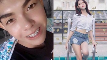 Selain operasi kelamin, operasi wajah pun dilakukan. Foto: Facebook