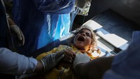 Jerit Anak-anak Palestina yang Terluka Akibat Serangan Israel