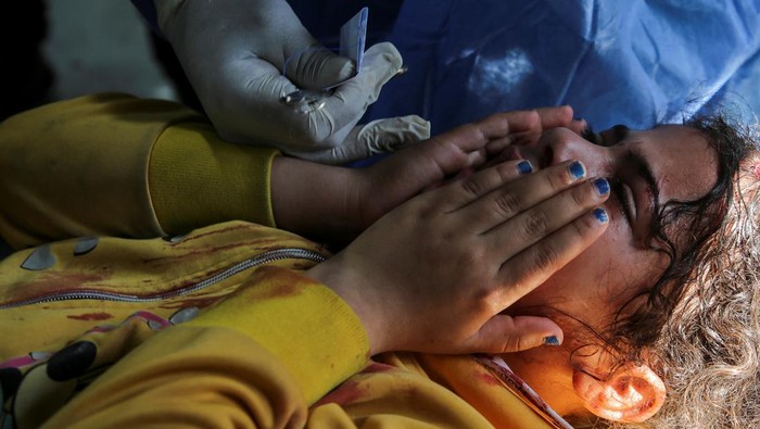 A Palestinian girl wounded in an Israeli strike reacts as she is treated at a hospital as Israeli forces launch a ground and air operation in the eastern part of Rafah, amid the ongoing conflict between Israel and Hamas, in Rafah, in the southern Gaza Strip May 7, 2024. REUTERS/Hatem Khaled