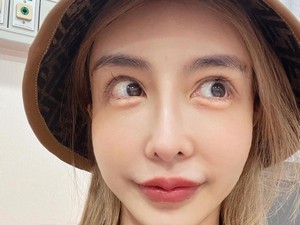 Melalui Pemindai Bandara, Model Kaget Nemu Benda Aneh di Wajah