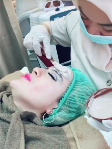 TikTokers, Yuni Jasmine memperlihatkan wajah aslinya saat sedang melakukan perawatan kecantikan. Unggahan tersebut langsung viral di media sosial