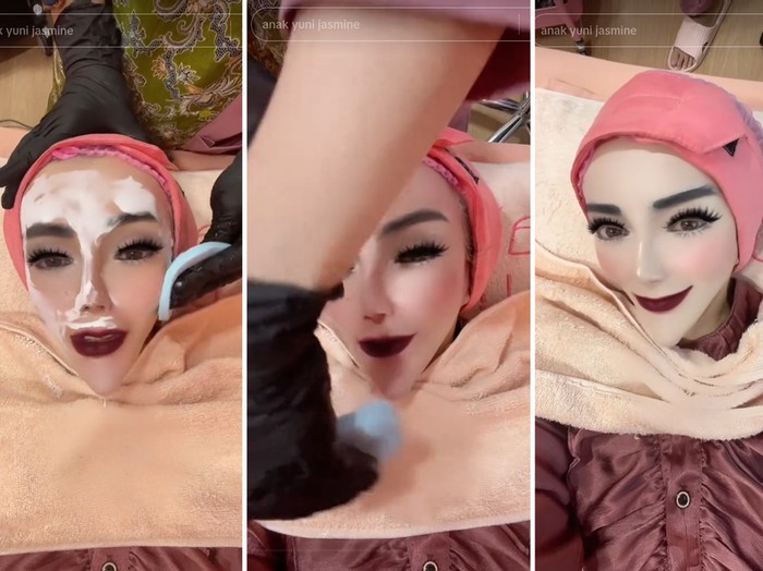 TikTokers, Yuni Jasmine memperlihatkan wajah aslinya saat sedang melakukan perawatan kecantikan. Unggahan tersebut langsung viral di media sosial