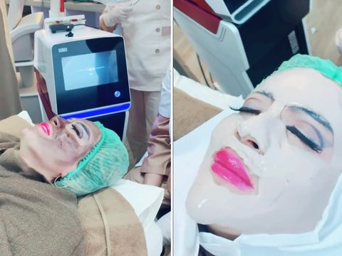 TikTokers, Yuni Jasmine memperlihatkan wajah aslinya saat sedang melakukan perawatan kecantikan. Unggahan tersebut langsung viral di media sosial