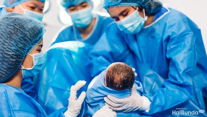 5 Risiko Kelahiran Caesar yang Jarang Dibahas