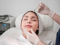Gen Z Dikit-dikit Botox-Filler Biar Awet Muda, Dermatolog Bilang Gini