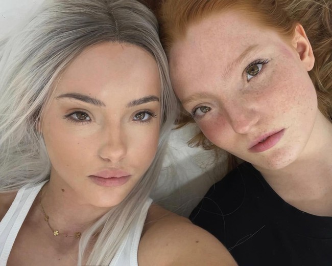 Dikatakan jika ia belum pernah memeriksakan kondisinya secara medis namun kondisi tersebut disebut memang diwariskan dalam keluarganya. Anak Magda yang berusia dua tahun juga mengidap sindrom Waardenburg. Foto: Instagram Magda Myszczynska