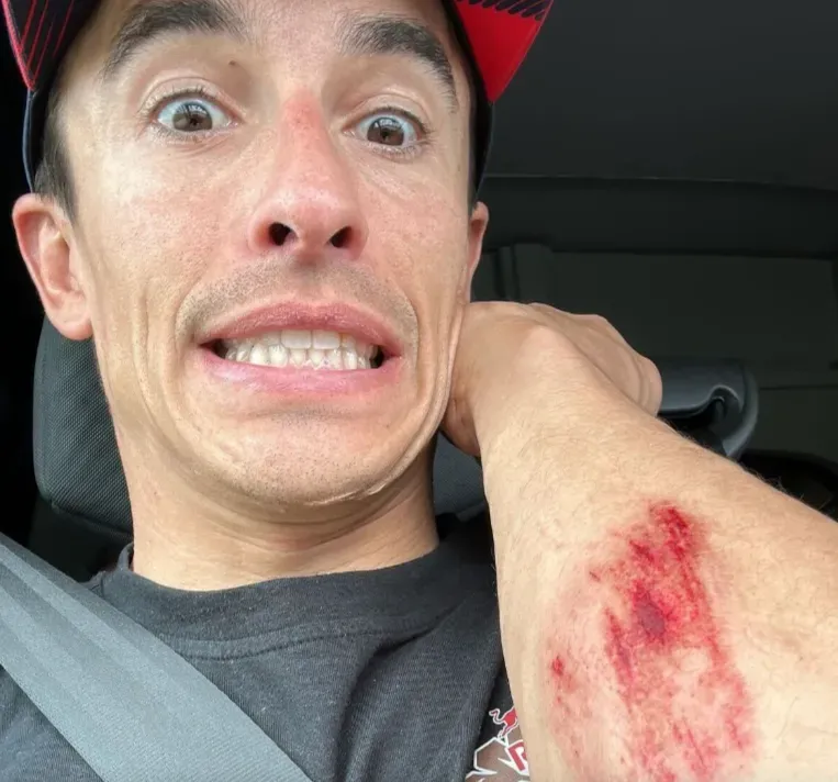 Marc Marquez lecet karena jatuh saat latihan.