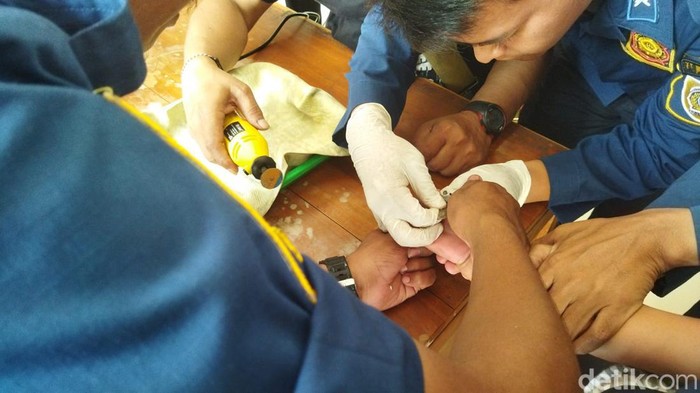 Evakuasi ring besi di jari balita oleh tim RSD Bagas Waras dan Damkar Klaten.