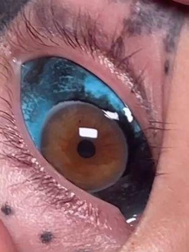 Amber Luke, gadis naga yang tato bola mata