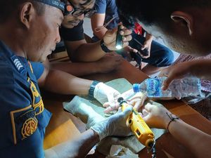 Cicin Tak Bisa Lepas hingga Jari Bengkak, Nenek 80 Tahun Datangi Damkar Klaten