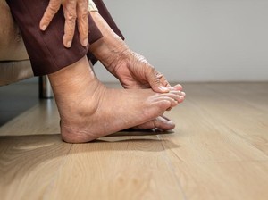 14 Penyebab Kaki Bengkak, Benarkah Gejala Sakit Ginjal?