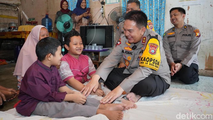 Kapolda Riau, Irjen Mohammmad Iqbal bertemu kedua bocah penderita kerapuhan tulang. (Raja Adil Siregar/detikSumut)