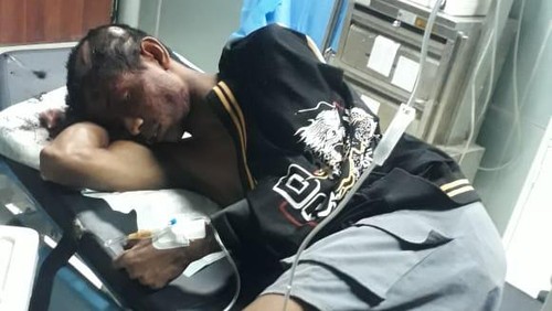 Jekson Mbatu (21) saat menjalani perawatan medis di RS Naibonat Kabupaten Kupang, NTT, setelah dibacok kakaknya, Jumat (24/5/2024).