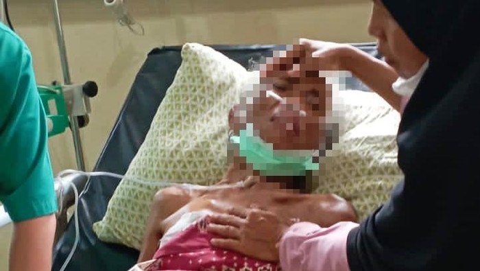 Korban penganiayaan anak kandung di Karangasem saat dirawat di rumah sakit.