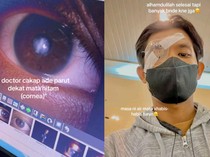 Curhat Pemuda 21 Tahun Transplantasi Kornea gegara Rabun Imbas Sering Kucek Mata