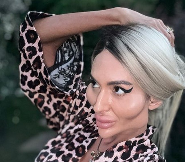 Bukan karena kesalahan operasi plastik, namun penampilan tersebut yang diinginkan dan dibanggakan oleh Anastasia. Padahal 10 tahun lalu wajahnya tidak seperti ini. Foto: dok. Instagram @ justqueen88