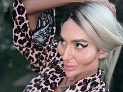 Foto Before After Wanita Pemilik Pipi Terbesar di Dunia, Dulu Tampil Normal