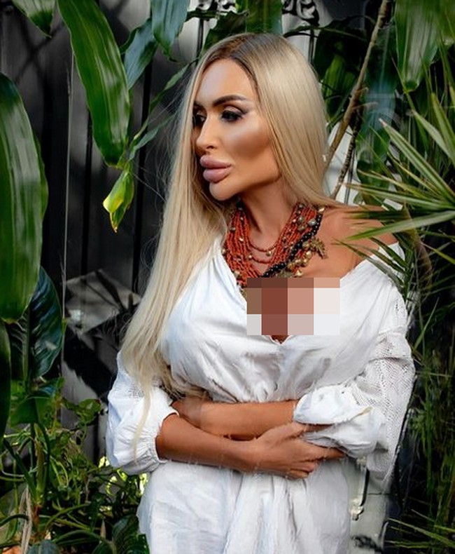 Di era media sosial yang dipenuhi dengan berbagai tren kecantikan, Anastasiia Pokreshchuk muncul sebagai salah satu fenomena yang paling menarik perhatian. Wanita asal Ukraina itu jadi sorotan dengan pipi bengkak tidak natural hasil filler. Foto: dok. Instagram @ justqueen88