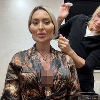 Selebgram itu terus membagikan perkembangan operasinya secara daring, dan dalam sebuah unggahan tahun lalu yang menampilkan hasil operasinya. Anastasia pun terus ingin membesarkan pipinya. Semua kecantikan yang kalian lihat adalah hasil karya @plastikaistanbul_. Tapi aku ingin sedikit lagi.” Foto: dok. Instagram @ justqueen88