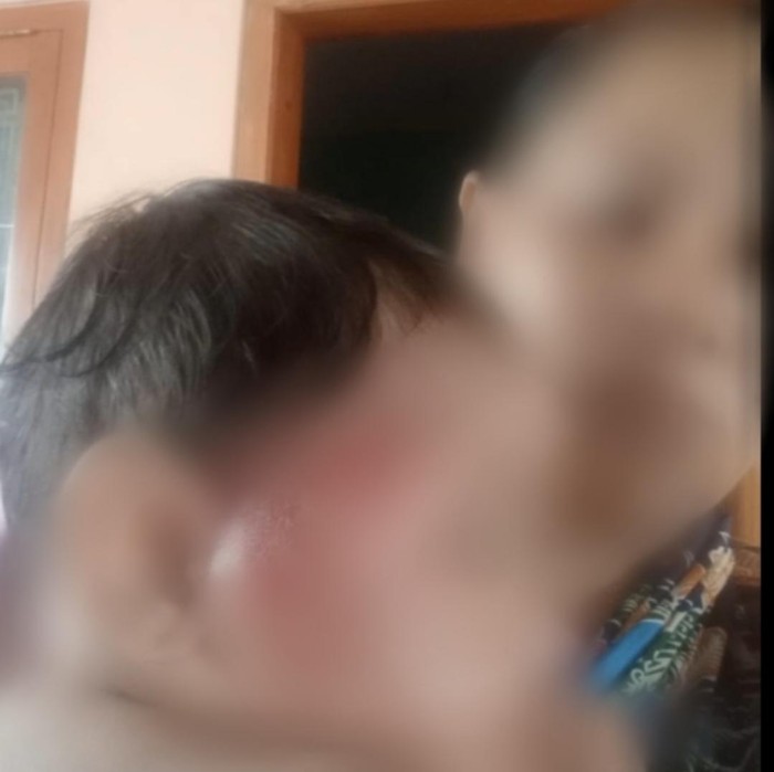 Penganiayaan balita di Probolinggo