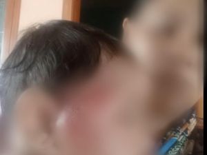 Bayi 8 Bulan di Probolinggo Dianiaya Ayah Kandung