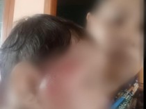 Bayi 8 Bulan di Probolinggo Dianiaya Ayah Kandung