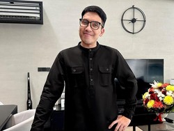 Penampilan Terbaru Desta Usai Transplantasi Rambut & Brewok Rp 135 Juta