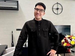 Penampilan Terbaru Desta Usai Transplantasi Rambut & Brewok Rp 135 Juta