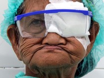 Ratusan Lansia di Aceh Ikuti Operasi Katarak Gratis di Hari Lanjut Usia Nasional