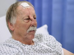 Kisah di Balik Pria yang Ganti Hidungnya Seperti Belalai Gajah