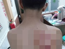 Babak Belur Santri Disabet Selang Senior gegara Sering Nongkrong