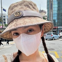 Alasannya melakukan rhinoplasty untuk merekonstruksi bentuk hidungnya yang sedikit bengkok dan menonjol. Sementara face contouring bertujuan membuat wajah lebih tirus dan proporsional. Foto: dok. Instagram Angel Karamoy