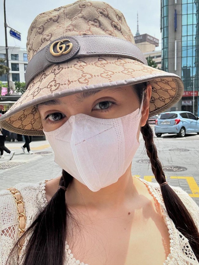 Alasannya melakukan rhinoplasty untuk merekonstruksi bentuk hidungnya yang sedikit bengkok dan menonjol. Sementara face contouring bertujuan membuat wajah lebih tirus dan proporsional. Foto: dok. Instagram Angel Karamoy