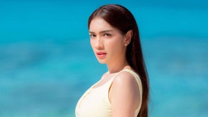 Ini adalah Angel Karamoy dengan wajah sebelum operasi plastik. Foto: dok. Instagram Angel Karamoy