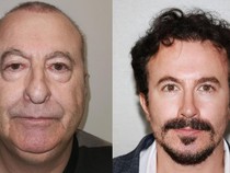 Begini Penampilan Pria usai Oplas yang Bikin Terheran-heran, Disebut Editan