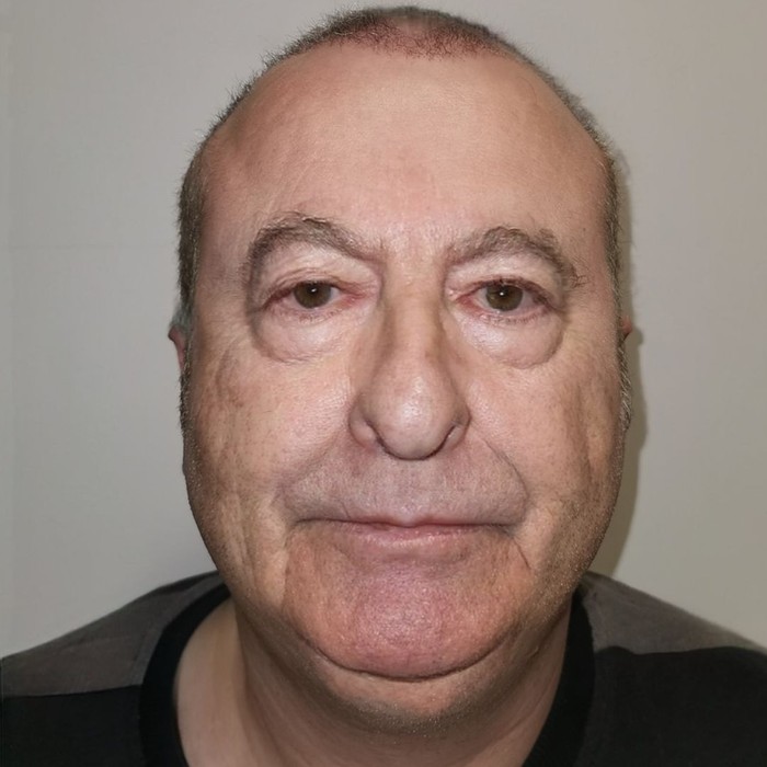 Viral penampilan bapak-bapak pasca oplas.