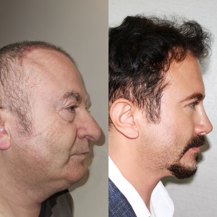 Viral penampilan bapak-bapak pasca oplas.