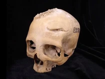 Tengkorak Berusia 4.000 Tahun Jadi Bukti Kecanggihan Medis di Era Mesir Kuno